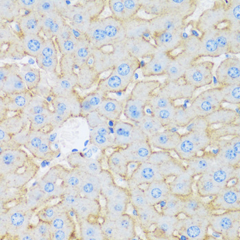 ASGR1 Rabbit Polyclonal Antibody - Image 4