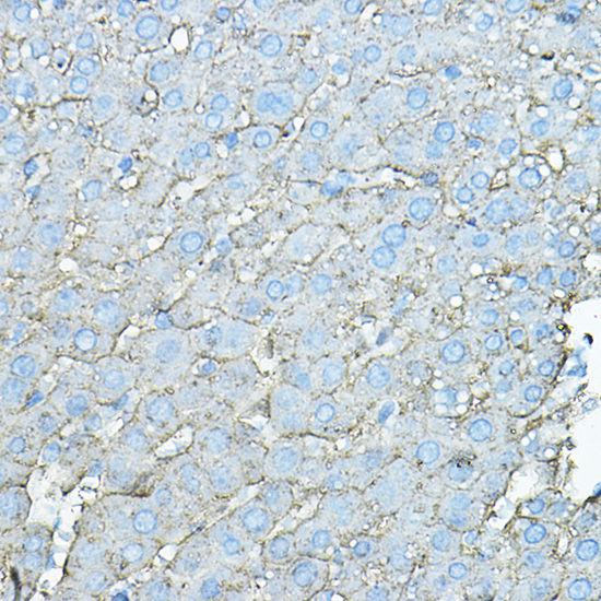 ASGR1 Rabbit Polyclonal Antibody - Image 5