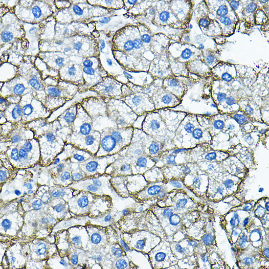 ASGR1 Rabbit Polyclonal Antibody - Image 6