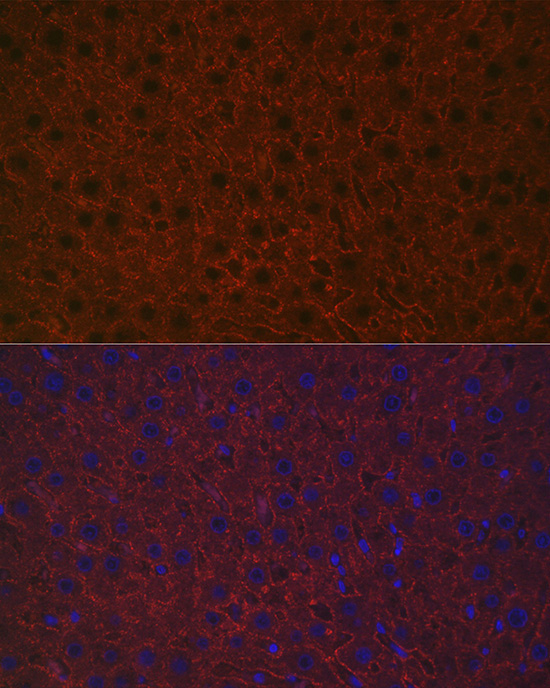ASGR1 Rabbit Polyclonal Antibody - Image 7