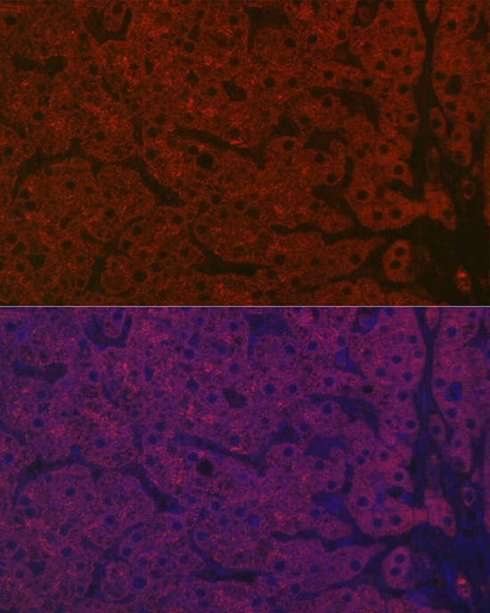 ASGR1 Rabbit Polyclonal Antibody - Image 8