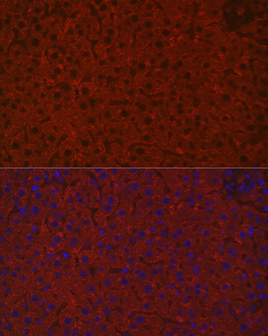 ASGR1 Rabbit Polyclonal Antibody - Image 9