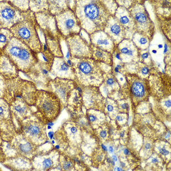 ASGR1 Rabbit Polyclonal Antibody - Image 2