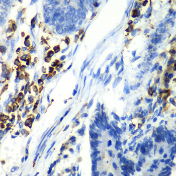 ASGR1 Rabbit Polyclonal Antibody - Image 3