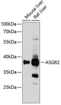 ASGR2 Rabbit Polyclonal Antibody