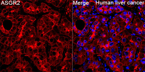 ASGR2 Rabbit Polyclonal Antibody - Image 2