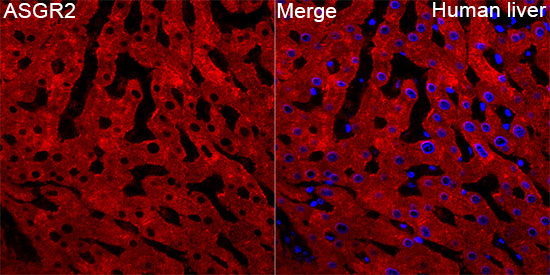 ASGR2 Rabbit Polyclonal Antibody - Image 3