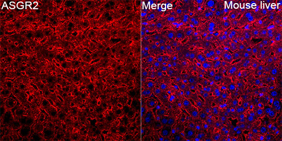 ASGR2 Rabbit Polyclonal Antibody - Image 4