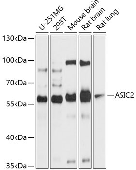 ASIC2 Rabbit Polyclonal Antibody