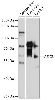 ASIC3 Rabbit Polyclonal Antibody