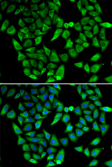 ASIP Rabbit Polyclonal Antibody