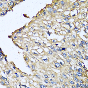 ASIP Rabbit Polyclonal Antibody