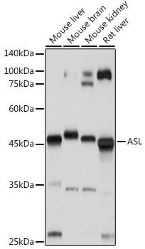 ASL Rabbit Polyclonal Antibody