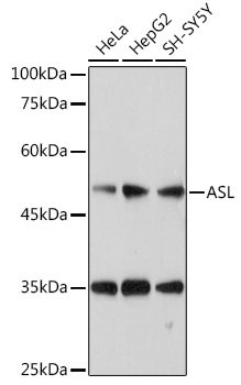 ASL Rabbit Polyclonal Antibody - Image 2
