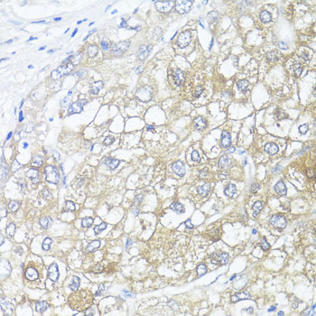 ASL Rabbit Polyclonal Antibody - Image 3