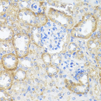 ASL Rabbit Polyclonal Antibody - Image 4