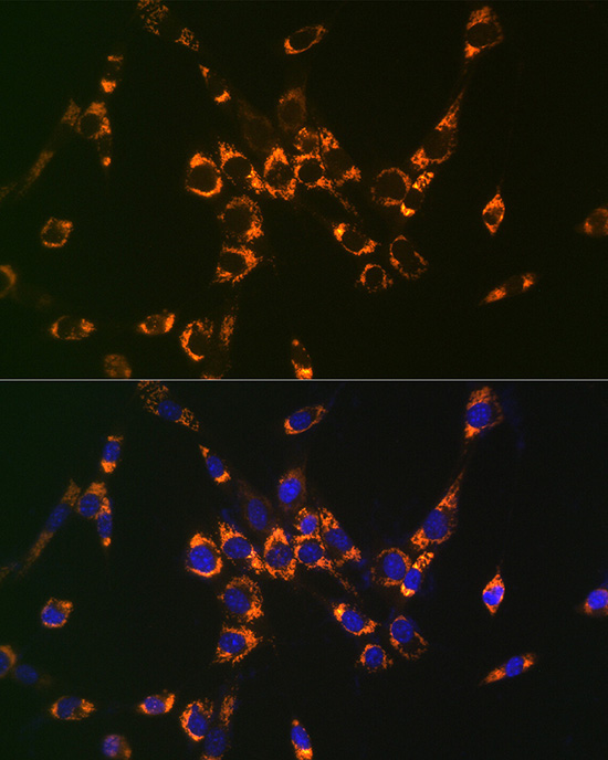 ASL Rabbit Polyclonal Antibody - Image 5