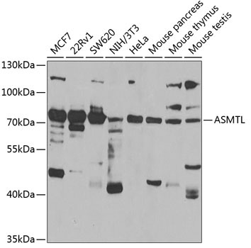 ASMTL Rabbit Polyclonal Antibody