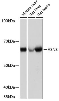 ASNS Rabbit Monoclonal Antibody