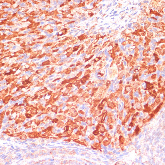 ASNS Rabbit Polyclonal Antibody - Image 2