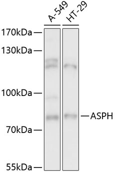 ASPH Rabbit Polyclonal Antibody
