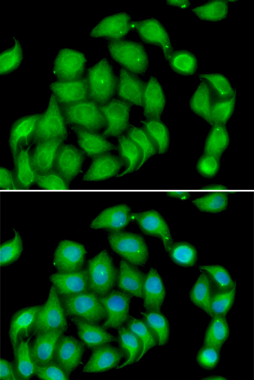 ASPH Rabbit Polyclonal Antibody