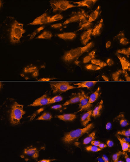 ASPM Rabbit Polyclonal Antibody