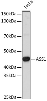 ASS1 Rabbit Polyclonal Antibody - Image 2
