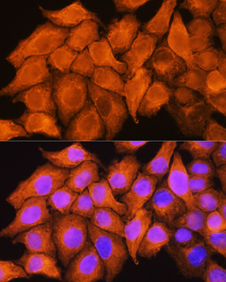 ASS1 Rabbit Polyclonal Antibody - Image 3