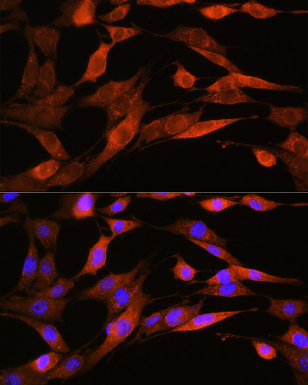ASS1 Rabbit Polyclonal Antibody - Image 4