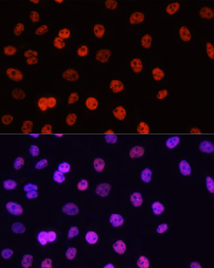 Asymmetric DiMethyl-Histone H3-R17 Rabbit Polyclonal Antibody - Image 4
