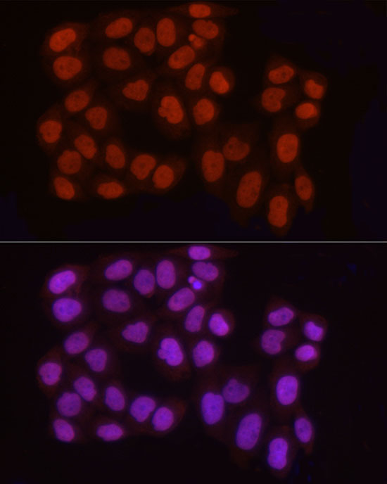 Asymmetric DiMethyl-Histone H3-R2 Rabbit Polyclonal Antibody - Image 3
