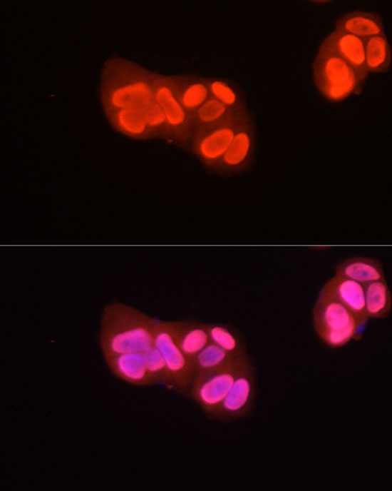 Asymmetric DiMethyl-Histone H3-R2 Rabbit Polyclonal Antibody - Image 4