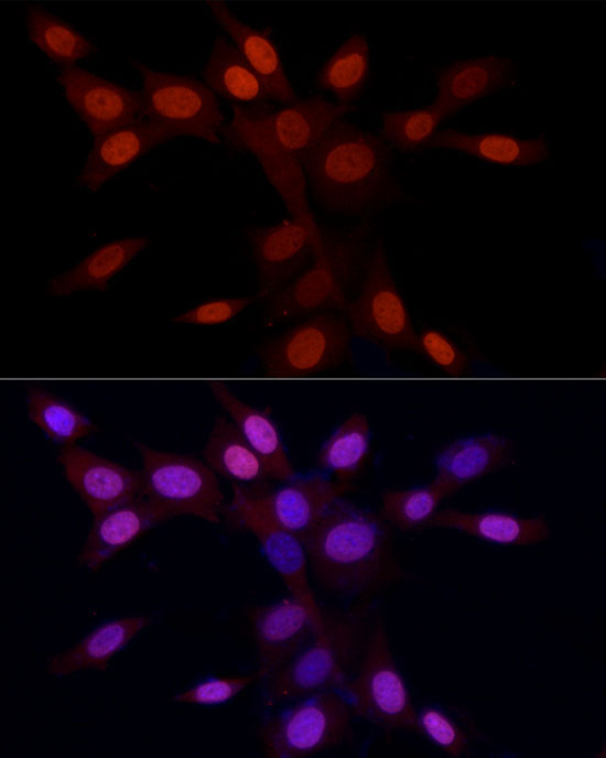 Asymmetric DiMethyl-Histone H3-R2 Rabbit Polyclonal Antibody - Image 5
