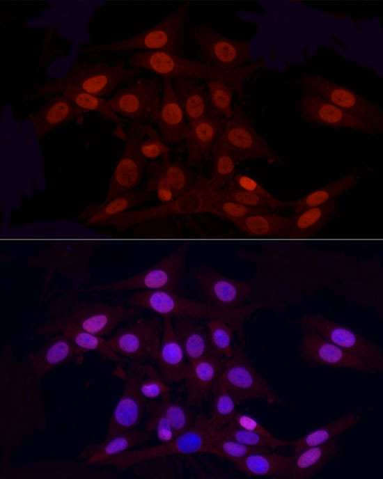 Asymmetric DiMethyl-Histone H3-R2 Rabbit Polyclonal Antibody - Image 6