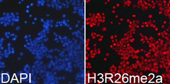 Asymmetric DiMethyl-Histone H3-R26 Rabbit Polyclonal Antibody - Image 2