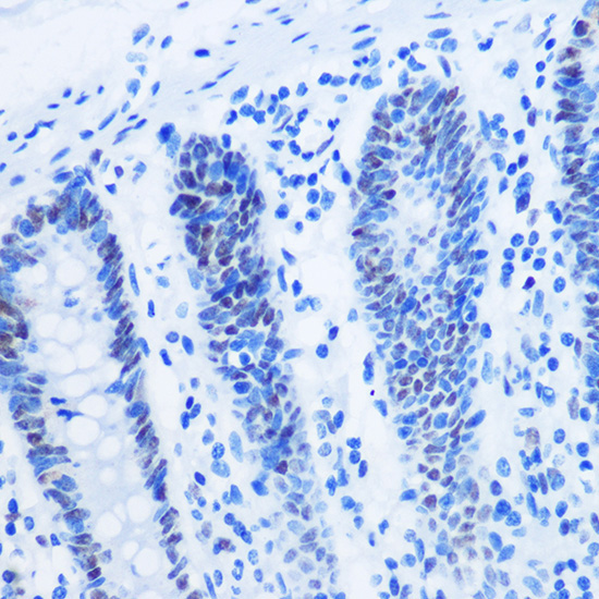 Asymmetric DiMethyl-Histone H3-R8 Rabbit Polyclonal Antibody - Image 3