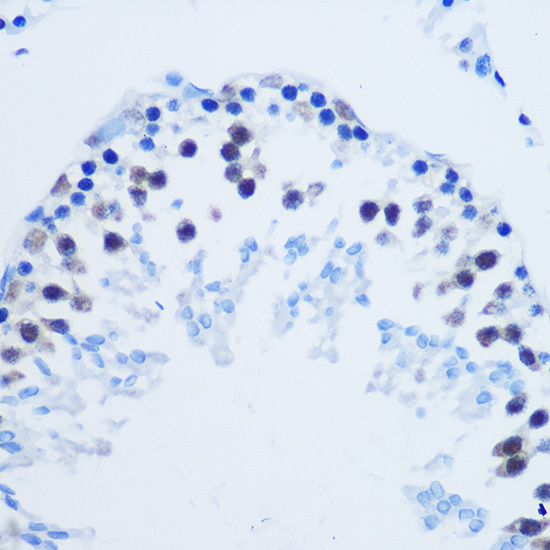 Asymmetric DiMethyl-Histone H3-R8 Rabbit Polyclonal Antibody - Image 4
