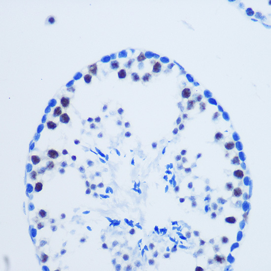 Asymmetric DiMethyl-Histone H3-R8 Rabbit Polyclonal Antibody - Image 5