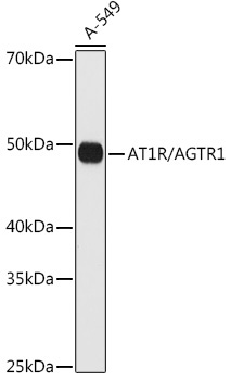 AT1R/AGTR1 Rabbit Monoclonal Antibody