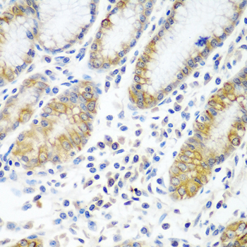 ATAD3A Rabbit Polyclonal Antibody - Image 2