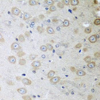 ATAD3A Rabbit Polyclonal Antibody - Image 3