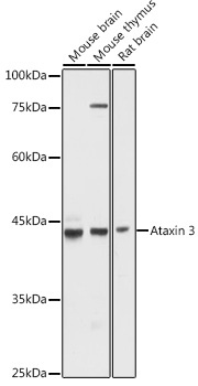 Ataxin-3 (ATXN3) Rabbit Polyclonal Antibody