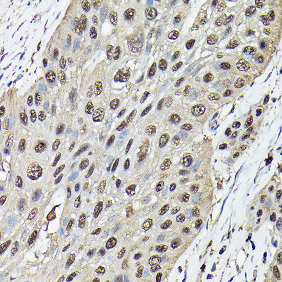 Ataxin-3 (ATXN3) Rabbit Polyclonal Antibody - Image 2