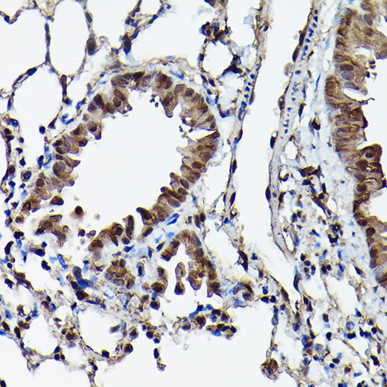 Ataxin-3 (ATXN3) Rabbit Polyclonal Antibody - Image 3