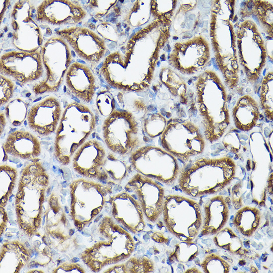Ataxin-3 (ATXN3) Rabbit Polyclonal Antibody - Image 4