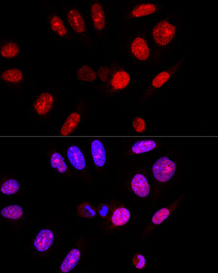 Ataxin-3 (ATXN3) Rabbit Polyclonal Antibody - Image 5
