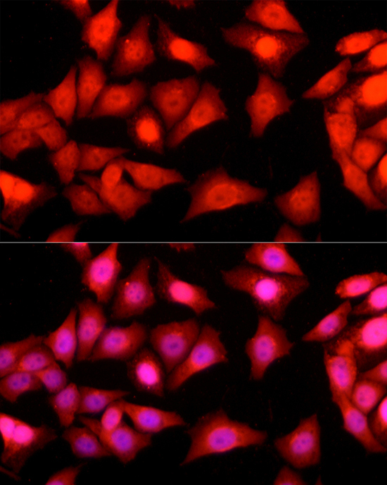 Ataxin-3 (ATXN3) Rabbit Polyclonal Antibody - Image 6