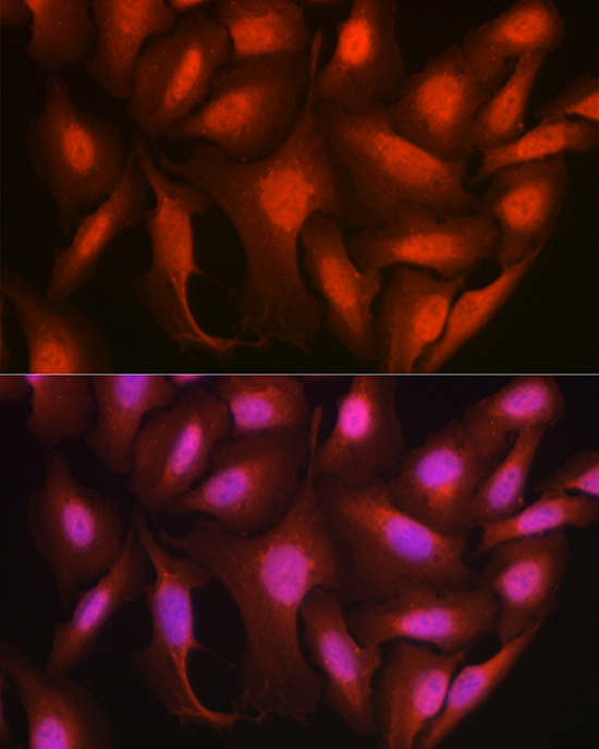 Ataxin-3 (ATXN3) Rabbit Polyclonal Antibody - Image 7