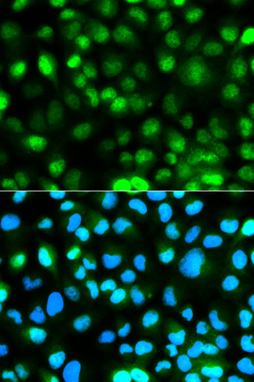 Ataxin-3 (ATXN3) Rabbit Polyclonal Antibody - Image 2